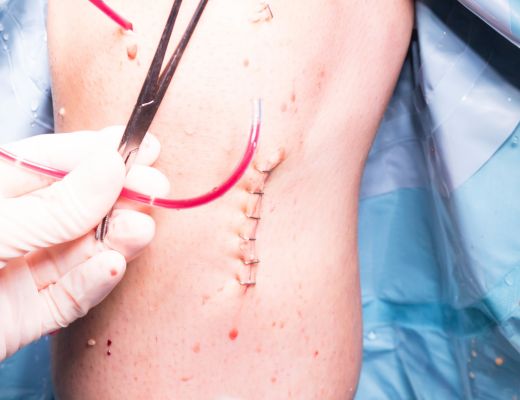 Microvascular Surgery