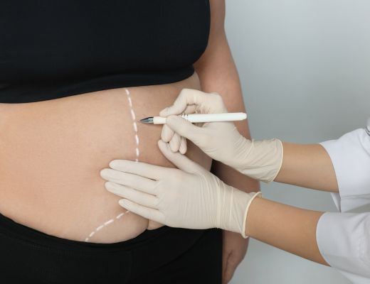 Lipoma Cyst Warts Mole Removal